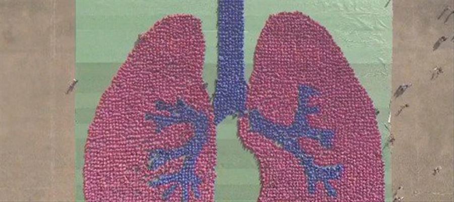 IHG'Largest Human Image of an Organ (Lung)'